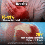 Arthritis (Pain Away Relief Kit) - Image 6